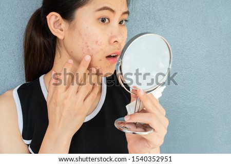 Portrait of Asian woman worry about her face when she saw the problem of acne inflammation and scar by the mini mirror. Conceptual shot of Acne & Problem Skin on female face. Royalty-Free Stock Photo #1540352951