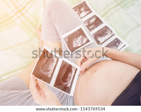 Close up Pregnant woman feeling happy love at home while looking of her Ultrasonography. The young expecting mother holding baby Ultrasound in belly. Maternity prenatal care.