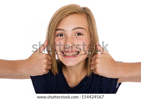 A cute young girl wearing orthodontic headgear Royalty-Free Stock Photo #154424567