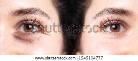 Eye wrinkles, aging sign, rejuvenation close up Royalty-Free Stock Photo #1545104777