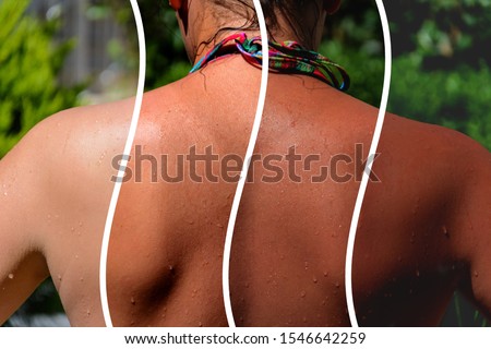 photo collage. back of a girl in a bikini with a demonstration of different shades of tan Royalty-Free Stock Photo #1546642259
