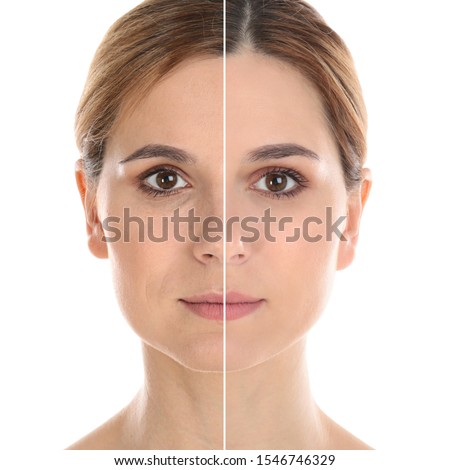 Woman before and after plastic surgery on white background Royalty-Free Stock Photo #1546746329