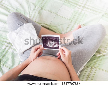 Close up Pregnant woman feeling happy love at home while looking of her Ultrasonography. The young expecting mother holding baby Ultrasound in belly. Maternity prenatal care abdomen.
