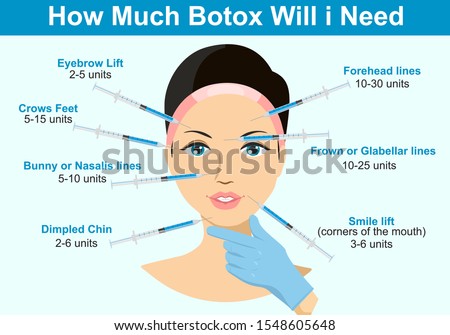 How much Botox will I need. Infographics. Botox injection. Woman facial wrinkle treatment. Royalty-Free Stock Photo #1548605648