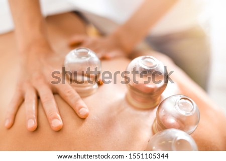 Detail of a woman therapist hands giving cupping treatment on back.  Royalty-Free Stock Photo #1551105344