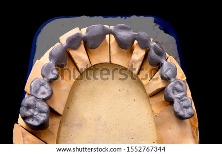 Metal frames of ceramic-metal crowns in articulator. Cermet bridge denture. Closeup dental photo on black background, isolate.