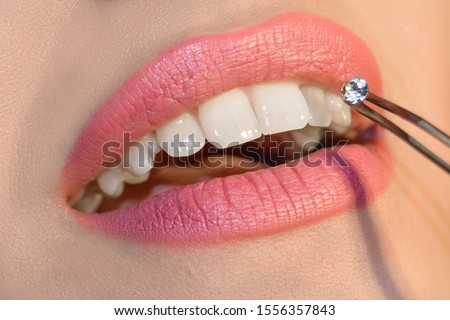 Dentist doctor select a gem or rhinestone for the patient’s teeth, Mouth close up Royalty-Free Stock Photo #1556357843