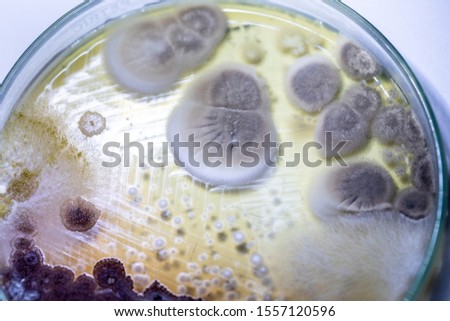Mold Beautiful, Colony of Characteristics of Fungus (Mold) in culture medium plate from laboratory microbiology.

