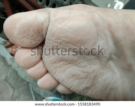 
Foot skin that looks wrinkled from being submerged in water