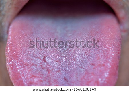 Macro photography of part of the tongue of an adult male