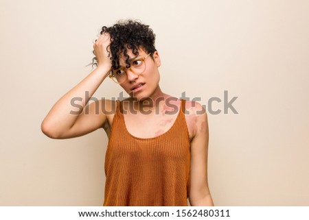 Young african american woman with skin birth mark tired and very sleepy keeping hand on head.