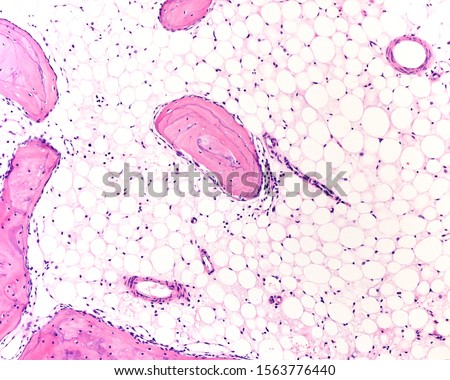 Trabeculae of cancellous bone, also called trabecular or spongy bone separated by large spaces occupied by adipose tissue of yellow bone marrow.  Royalty-Free Stock Photo #1563776440