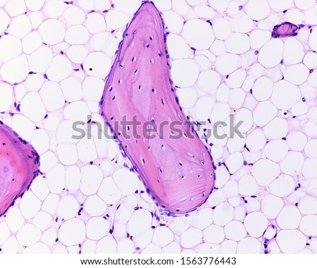 Light microscope micrograph showing a bone trabecula of cancellous or spongy bone tissue surrounded by yellow marrow. Bone lamellae and osteocytes can be seen in the trabeculae. Royalty-Free Stock Photo #1563776443