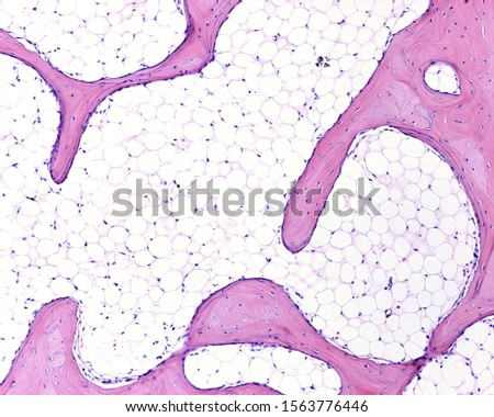 Light microscope micrograph showing a network of trabeculae of cancellous or spongy bone separated by large spaces occupied by adipose tissue of yellow bone marrow. Royalty-Free Stock Photo #1563776446