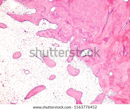 Limit between the cortical compact bone and the cancellous, trabecular or spongy bone. The spaces between bone trabeculae are occupied by adipose tissue of yellow bone marrow. Royalty-Free Stock Photo #1563776452