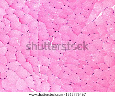 Low magnification light microscope micrograph of cross sectioned skeletal muscle fibers showing the presence of many nuclei (multinucleated cells) located in the cell periphery. Royalty-Free Stock Photo #1563776467