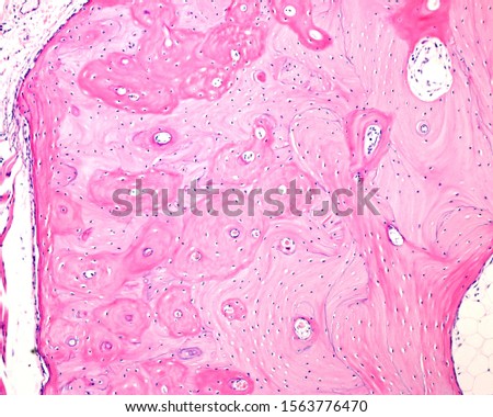 Compact cortical zone of a small bone. The round structures are osteons or Haversian systems, separated by interstitial lamellae. Parallel circumferential lamellae can be seen in both surfaces Royalty-Free Stock Photo #1563776470