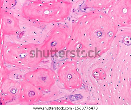 Compact cortical zone of a small bone. The round structures are osteons or Haversian systems, separated by interstitial lamellae. Parallel circumferential lamellae can be seen in both surfaces Royalty-Free Stock Photo #1563776473