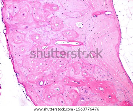 Compact cortical zone of a small bone. The round structures are osteons or Haversian systems, separated by interstitial lamellae. Parallel circumferential lamellae can be seen in both surfaces Royalty-Free Stock Photo #1563776476
