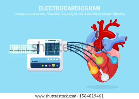 ECG machine isolated on background. Electrocardiogram monitor for diagnosis human heart with EKG graph. Medical equipment for hospital with chart of heartbeat rhythm. Vector flat design  Royalty-Free Stock Photo #1564019461
