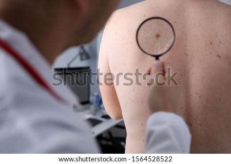 Male doctor look at magnifying glass on patient skin against hospital office background. Lesions danger problem therapy concept Royalty-Free Stock Photo #1564528522