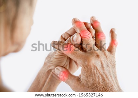 Asian woman hand suffering from joint pain with gout in finger Royalty-Free Stock Photo #1565327146