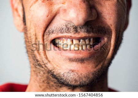 Bad men teeth with 