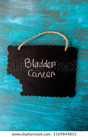 Symbol of Cancer Awareness design on blackboard. Photo is taken for healthcare and medical purpose. Writing with white chalk on blackboard. 