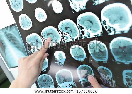 doctor view output CT scan. Royalty-Free Stock Photo #157370876