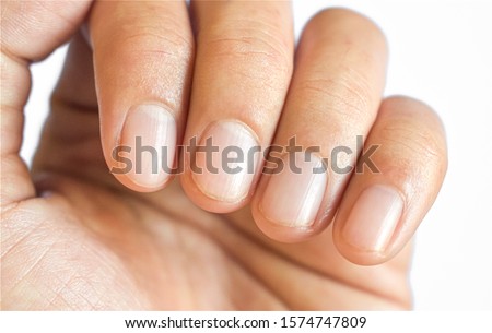 Small lunulae or half-moons at fingernails with longitudinal lines of Southeast Asian, Chinese young man. Isolated on white background. Royalty-Free Stock Photo #1574747809
