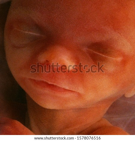 In-vitro image of a human fetus in the womb prior to birth - approx 12 weeks. Royalty-Free Stock Photo #1578076516