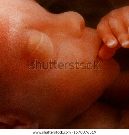 In-vitro image of a human fetus in the womb prior to birth - approx 12 weeks. Royalty-Free Stock Photo #1578076519