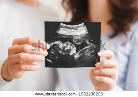 First sonography. Future parents holding ultrasound scan of their baby, enjoying photo of their unborn child, closeup.