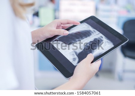 Doctors examining x-ray of chest and ribs on digital tablet