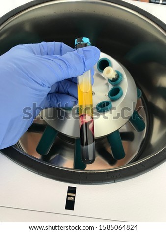 Prp preparation for sports medicine Royalty-Free Stock Photo #1585064824