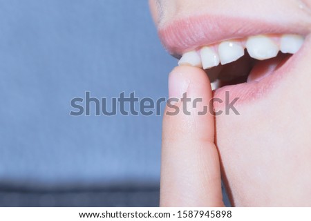 Baby tooth, close-up of the tooth that falls macro shot Royalty-Free Stock Photo #1587945898