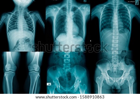 collection human x-ray image in blue tone Royalty-Free Stock Photo #1588910863
