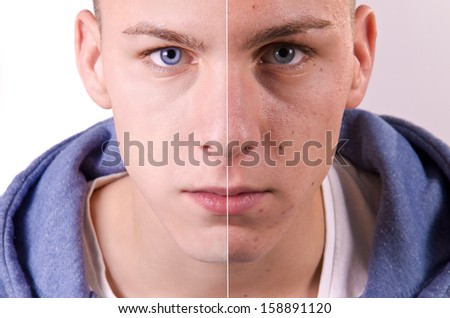 Face of handsome man before and after retouch. Royalty-Free Stock Photo #158891120