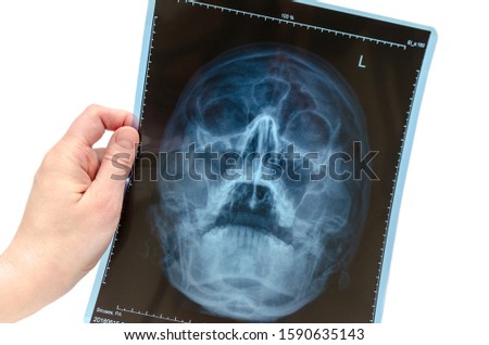 Fluorography. The doctor keeps a snapshot of the x-ray of the nose in his hands