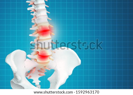 Realistic skeletal human spine and vertebral column or intervertebral discs on a dark background. Lower back pain. Vertebral column in glowing highlight as a medical health care concept. Royalty-Free Stock Photo #1592963170
