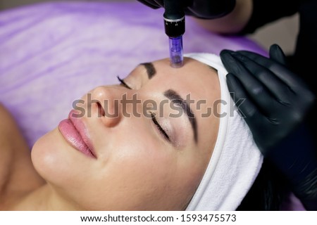 Beautician makes mesotherapy injections. Microneedle mesotherapy. Treatment of a woman by a beautician. Hardware cosmetology. Mesotherapy, facial area treatment, facial rejuvenation. face and forehead Royalty-Free Stock Photo #1593475573