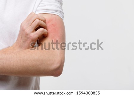 Close up of man scratching the itch on hand, isolated on grey background, copy space. Pruritus, animal food cosmetic allergy, dermatitis, insect bites, irritation concept.  Royalty-Free Stock Photo #1594300855