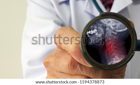 Orthopedist doctor check film X-ray of cervical spine spondylosis which is spinal disc degenerative disease. The patient is phone addiction and has neck pain. Medical diagnosis and treatment concept Royalty-Free Stock Photo #1594378873