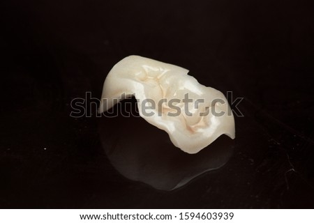 emax ceramic onlay on a black background Royalty-Free Stock Photo #1594603939