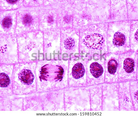 Mitosis in onion cells of the root meristem. In the central rowof cells, there is a prophase cell showing chromosomes. Below, a typical anaphase can be seen. Light microscope micrograph. Royalty-Free Stock Photo #159810452