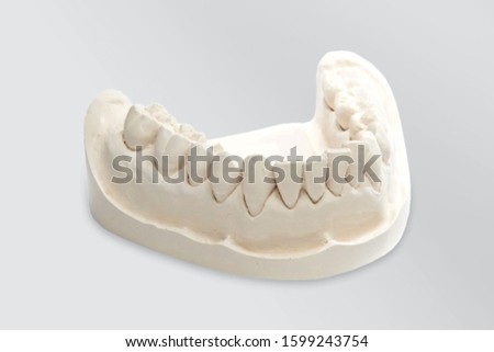 Dental Stone model, a dental mold with a prosthesis on a white background