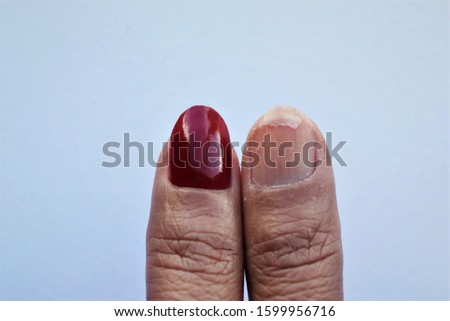 Close up women thumbs different together one red fingernail another broken fingernail. photo isolate copy space 