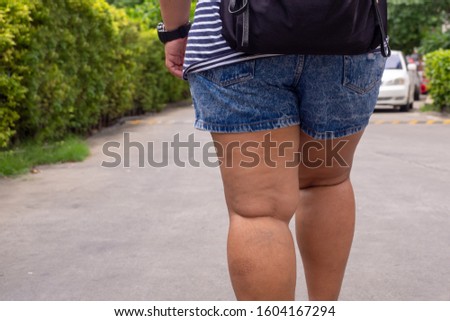 Close up leg fat women running shoes is walking on the street alone.