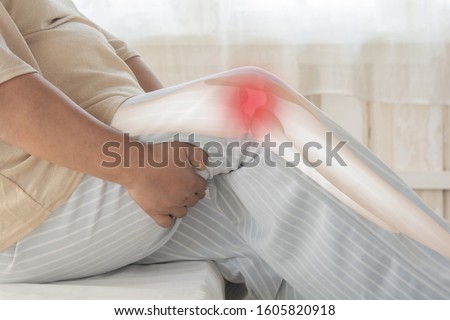 Obesity knee pain Musculoskeletal inflammation. And the legs support too much weight Royalty-Free Stock Photo #1605820918