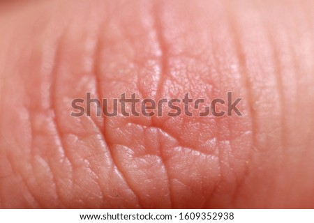 Photo of a finger skin taken with macro technique.
